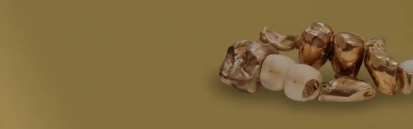 Hero Banner für Zahngold Ankauf Berlin Seite