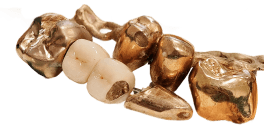 zahngold.png