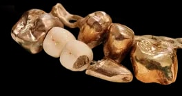 zahngold.webp